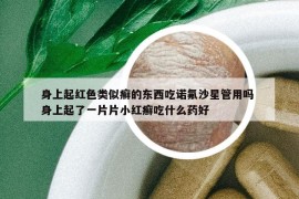 身上起红色类似癣的东西吃诺氟沙星管用吗 身上起了一片片小红癣吃什么药好
