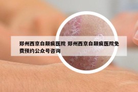 郑州西京白颠疯医院 郑州西京白颠疯医院免费预约公众号咨询