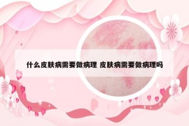 什么皮肤病需要做病理 皮肤病需要做病理吗
