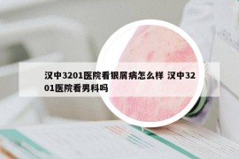 汉中3201医院看银屑病怎么样 汉中3201医院看男科吗
