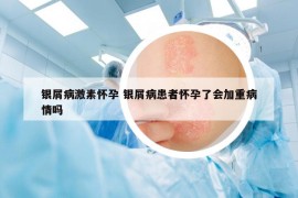 银屑病激素怀孕 银屑病患者怀孕了会加重病情吗