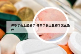 怀孕了头上起癣了 怀孕了头上起癣了怎么治疗
