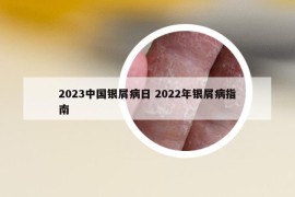 2023中国银屑病日 2022年银屑病指南