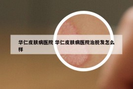 华仁皮肤病医院 华仁皮肤病医院治脱发怎么样