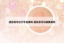 硫软膏可以只牛皮癣吗 硫软膏可以随便用吗