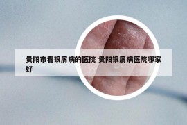 贵阳市看银屑病的医院 贵阳银屑病医院哪家好