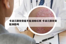 卡泊三醇软膏能不能消除红斑 卡泊三醇软膏能抹脸吗