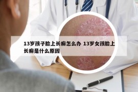 13岁孩子脸上长癣怎么办 13岁女孩脸上长癣是什么原因