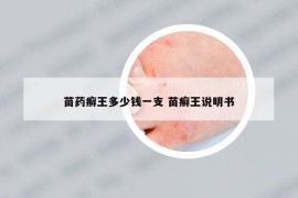 苗药癣王多少钱一支 苗癣王说明书