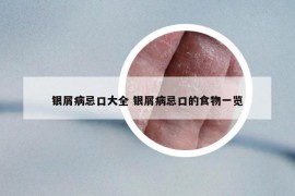 银屑病忌口大全 银屑病忌口的食物一览