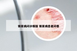 银屑病问诊模版 银屑病患者问卷