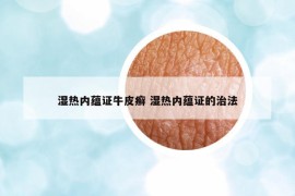 湿热内蕴证牛皮癣 湿热内蕴证的治法