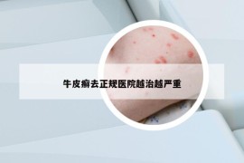 牛皮癣去正规医院越治越严重