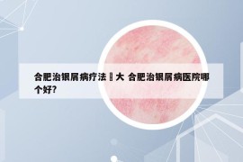 合肥治银屑病疗法軍大 合肥治银屑病医院哪个好?