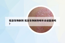 拓咨生物制剂 拓咨生物制剂明年会进医保吗?