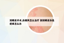 双眼皮手术,白癜风怎么治疗 割双眼皮白色疤痕怎么办