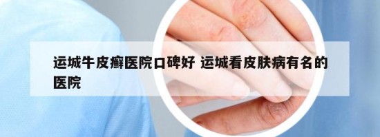 运城牛皮癣医院口碑好 运城看皮肤病有名的医院