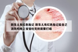 新生儿有红色胎记 新生儿有红色胎记能自己消失吗晚上宝宝吃完奶需要打嗝