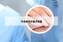 牛皮癣光疗最大剂量