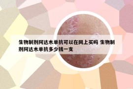 生物制剂阿达木单抗可以在网上买吗 生物制剂阿达木单抗多少钱一支