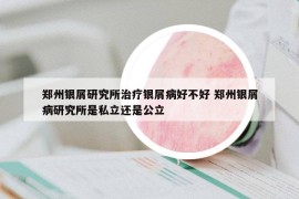 郑州银屑研究所治疗银屑病好不好 郑州银屑病研究所是私立还是公立