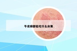 牛皮癣都能吃什么水果