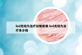 led光动力治疗仪银屑病 led光动力治疗多少钱