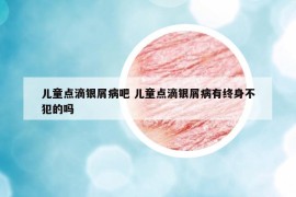 儿童点滴银屑病吧 儿童点滴银屑病有终身不犯的吗