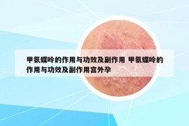 甲氨蝶呤的作用与功效及副作用 甲氨蝶呤的作用与功效及副作用宫外孕