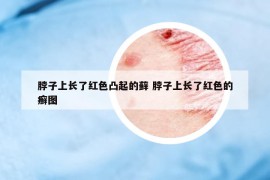 脖子上长了红色凸起的藓 脖子上长了红色的癣图