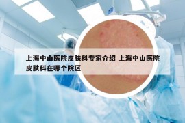 上海中山医院皮肤科专家介绍 上海中山医院皮肤科在哪个院区