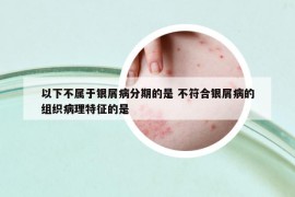 以下不属于银屑病分期的是 不符合银屑病的组织病理特征的是