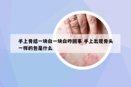 手上骨结一块白一块白咋回事 手上出现骨头一样的包是什么