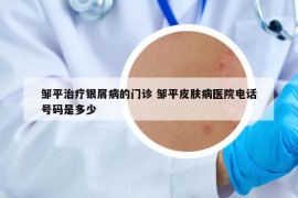 邹平治疗银屑病的门诊 邹平皮肤病医院电话号码是多少