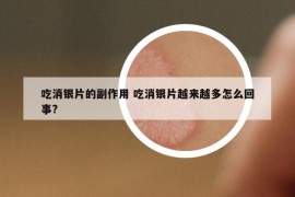 吃消银片的副作用 吃消银片越来越多怎么回事?