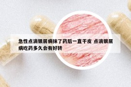 急性点滴银屑病抹了药后一直干皮 点滴银屑病吃药多久会有好转