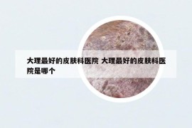 大理最好的皮肤科医院 大理最好的皮肤科医院是哪个