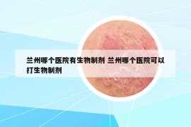 兰州哪个医院有生物制剂 兰州哪个医院可以打生物制剂