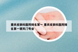 重庆皮肤科医院排名第一 重庆皮肤科医院排名第一朝天门专业