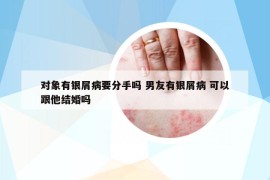 对象有银屑病要分手吗 男友有银屑病 可以跟他结婚吗