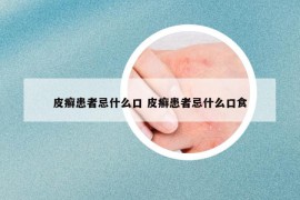 皮癣患者忌什么口 皮癣患者忌什么口食