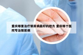 重庆哪里治疗银屑病最好的地方 重庆哪个医院专治银屑病