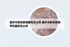 重庆华肤皮肤病医院怎么样 重庆华肤皮肤病专科医院怎么样