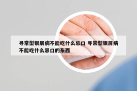 寻常型银屑病不能吃什么忌口 寻常型银屑病不能吃什么忌口的东西