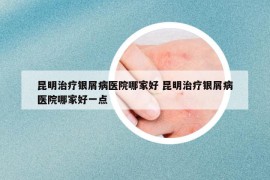 昆明治疗银屑病医院哪家好 昆明治疗银屑病医院哪家好一点