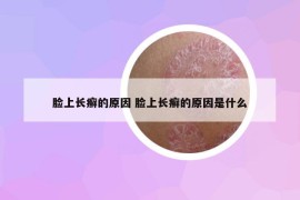 脸上长癣的原因 脸上长癣的原因是什么