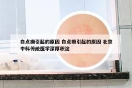 白点癫引起的原因 白点癫引起的原因 北京中科传统医学深厚积淀