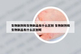 生物制剂和生物制品有什么区别 生物制剂和生物制品有什么区别呢