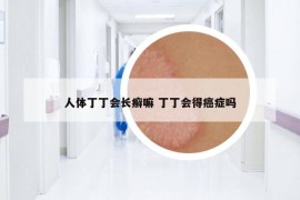 人体丁丁会长癣嘛 丁丁会得癌症吗