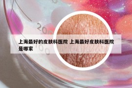 上海最好的皮肤科医院 上海最好皮肤科医院是哪家
